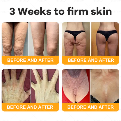 ✅✅Official Store:Made and Shipped from USA ✨ PUROSA® Bee Venom Skin Restoration Cream 🔥 LAST DAY 80% OFF