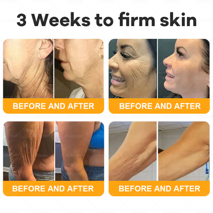 ✅✅Official Store:Made and Shipped from USA ✨ PUROSA® Bee Venom Skin Restoration Cream 🔥 LAST DAY 80% OFF